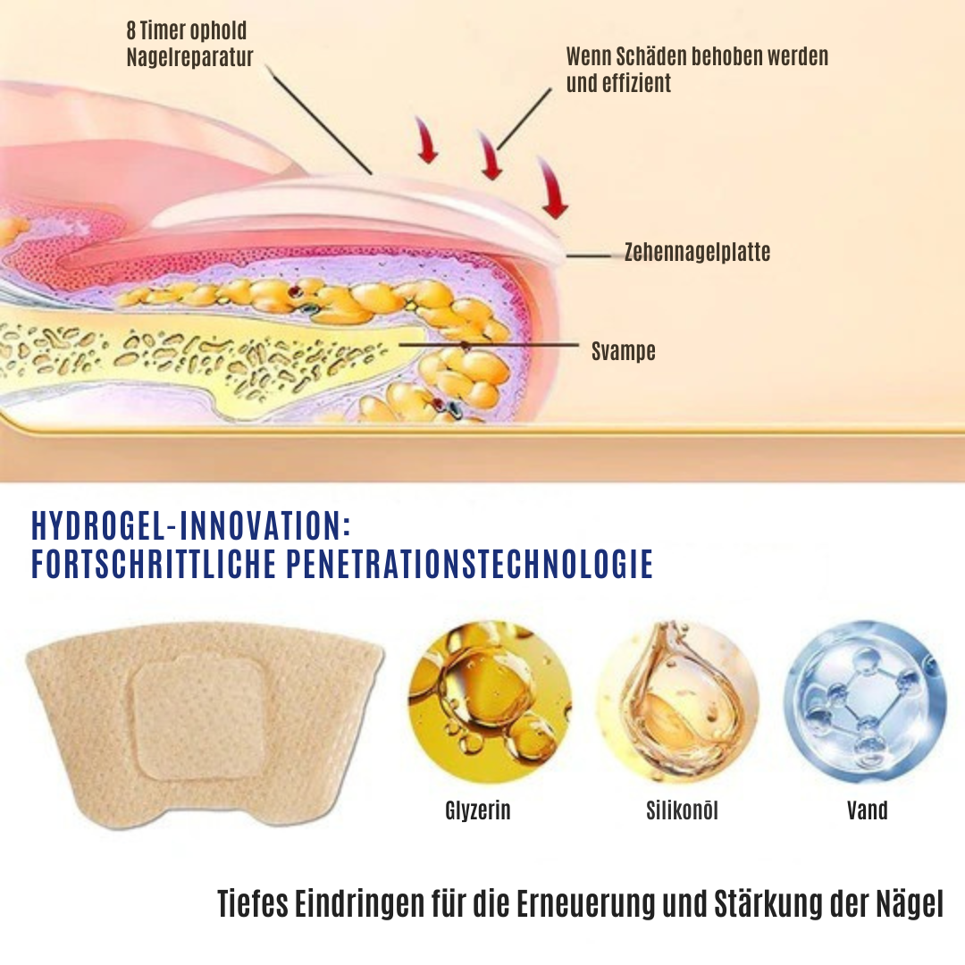NailRepair™ | Pflaster gegen Nagelpilz