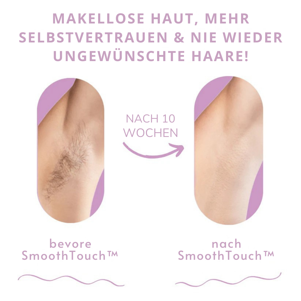 SmoothTouch™ | Die führende Laserhaarentfernung für zu Hause