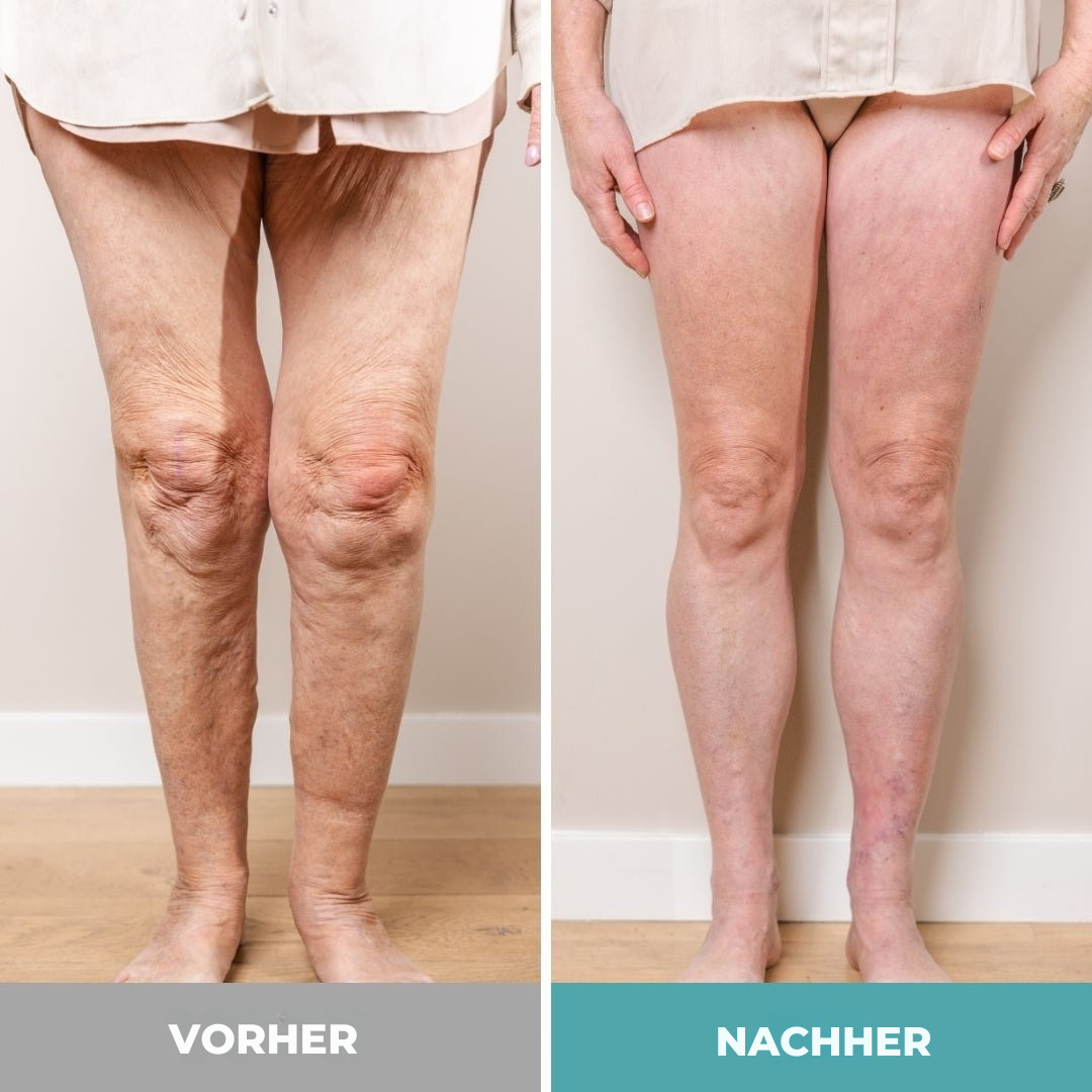ReliveX™ | Fußmassagegerät für ultimative Entspannung