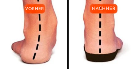 FeetRelief™ | Fußschmerzen loswerden - ohne teure Behandlungen oder unnötige Arztbesuche