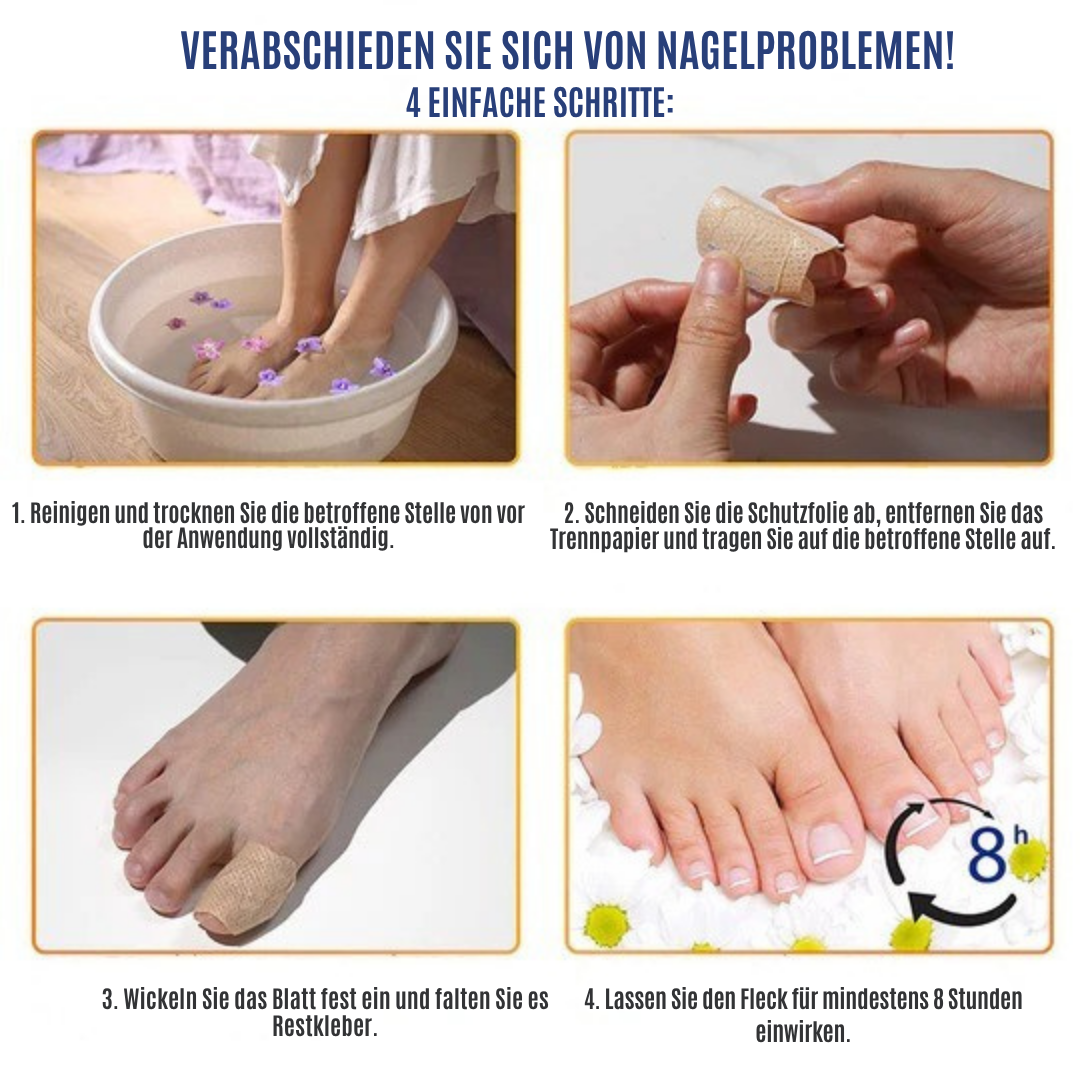 NailRepair™ | Pflaster gegen Nagelpilz