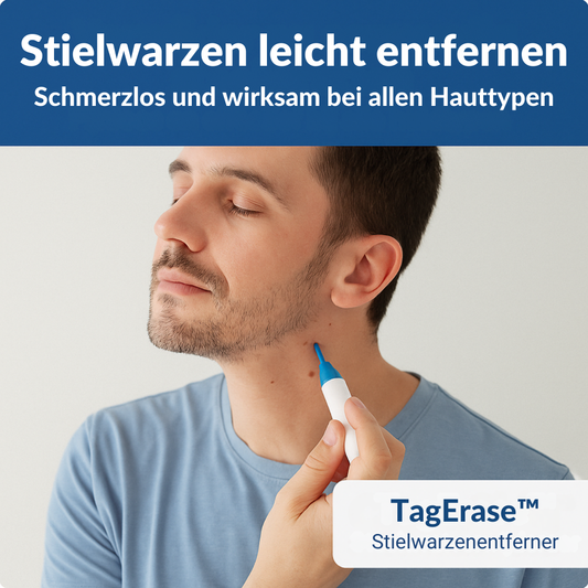 TagErase™ | Schluss mit Stielwarzen