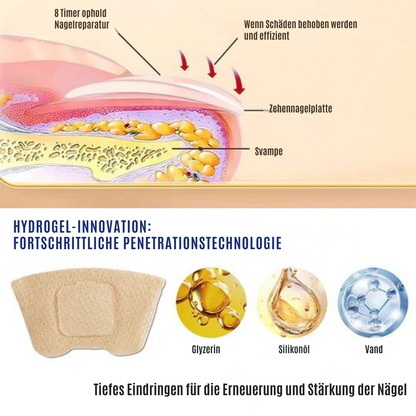 NailRepair™ | Pflaster gegen Nagelpilz