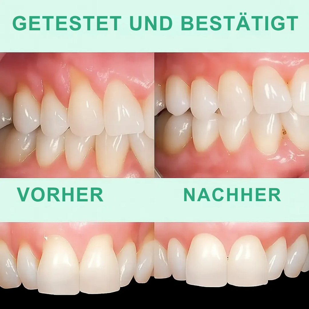 GumVital™ | Sichtbare Verbesserung des Zahnfleisches bei 93%!