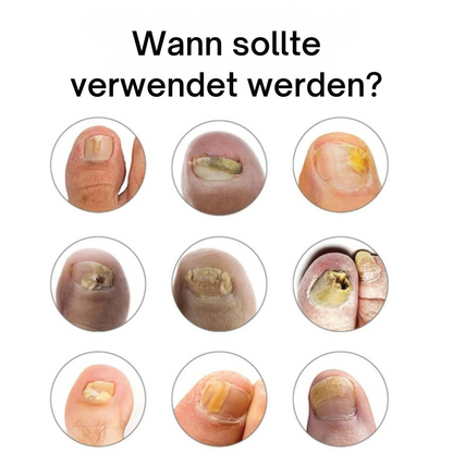 NailCure™ | Ultimative Nagelbehandlung für gesunde, schöne Nägel