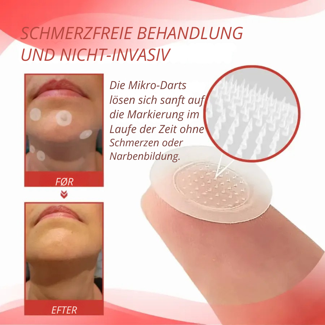 DermaPatch™ | Entfernen Sie schmerzfrei hängende Warzen – ohne Narben, ohne Schnitte, ohne Stress!