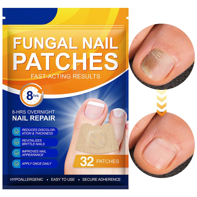 NailRepair™ | Pflaster gegen Nagelpilz