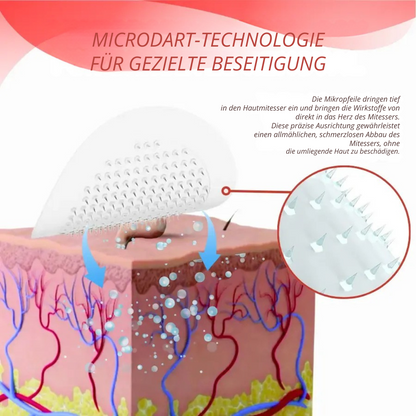 DermaPatch™ | Entfernen Sie schmerzfrei hängende Warzen – ohne Narben, ohne Schnitte, ohne Stress!