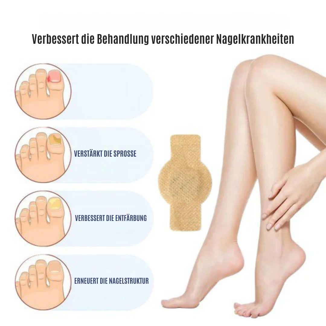 NailRepair™ | Pflaster gegen Nagelpilz
