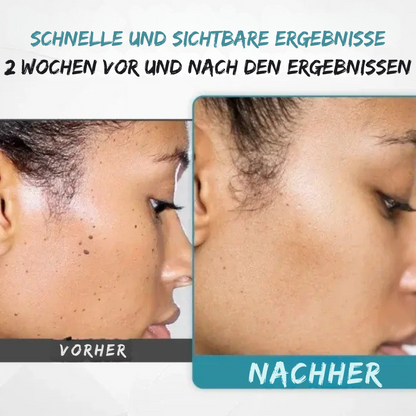 SilkLaser™ | Präzision und Sanftheit in einem