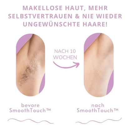 SmoothTouch™ | Die führende Laserhaarentfernung für zu Hause
