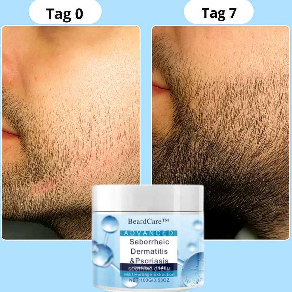 BeardCare™ | Premium Bartpflegeset – Stoppen Sie Juckreiz und Irritationen und erhalten Sie einen gesunden, gepflegten Bart