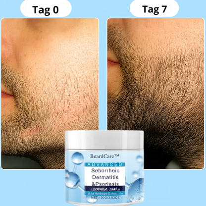 BeardCare™ | Premium Bartpflegeset – Stoppen Sie Juckreiz und Irritationen und erhalten Sie einen gesunden, gepflegten Bart