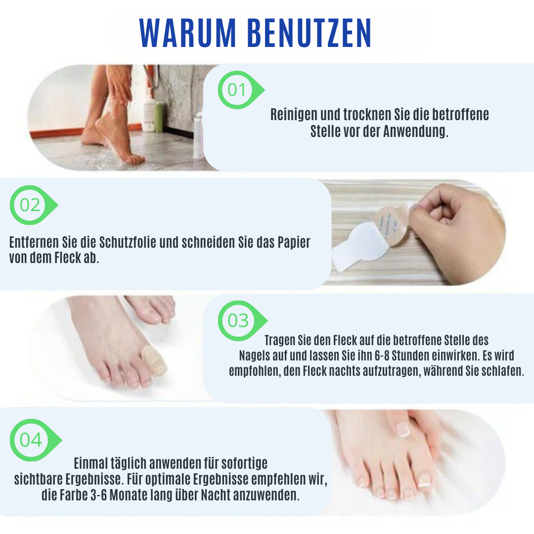 NailRepair™ | Pflaster gegen Nagelpilz