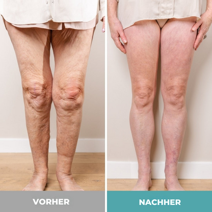 ReliveX™ | Fußmassagegerät für ultimative Entspannung