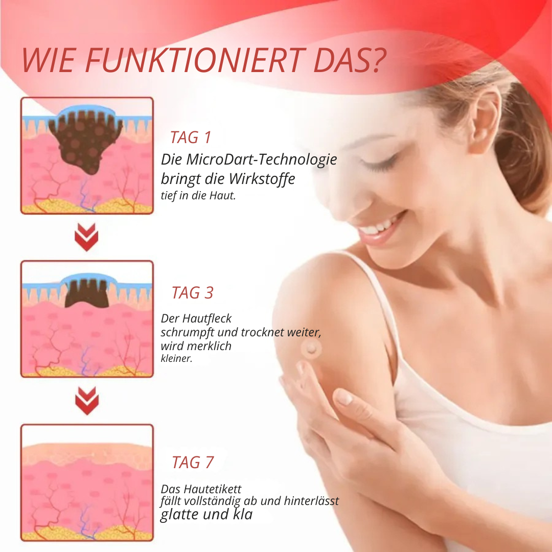 DermaPatch™ | Entfernen Sie schmerzfrei hängende Warzen – ohne Narben, ohne Schnitte, ohne Stress!