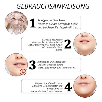 DermaPatch™ | Entfernen Sie schmerzfrei hängende Warzen – ohne Narben, ohne Schnitte, ohne Stress!
