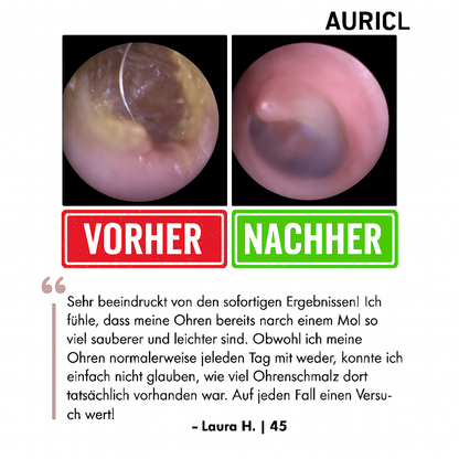 AuriClean™ | Elektrisches Ohrenschmalz-Entfernungskit