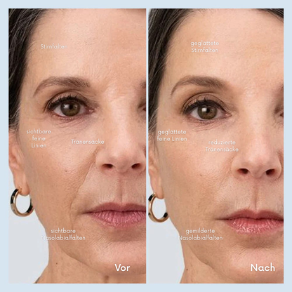 FacialWand™ | Schaffen Sie eine festere, glattere und strahlendere Haut