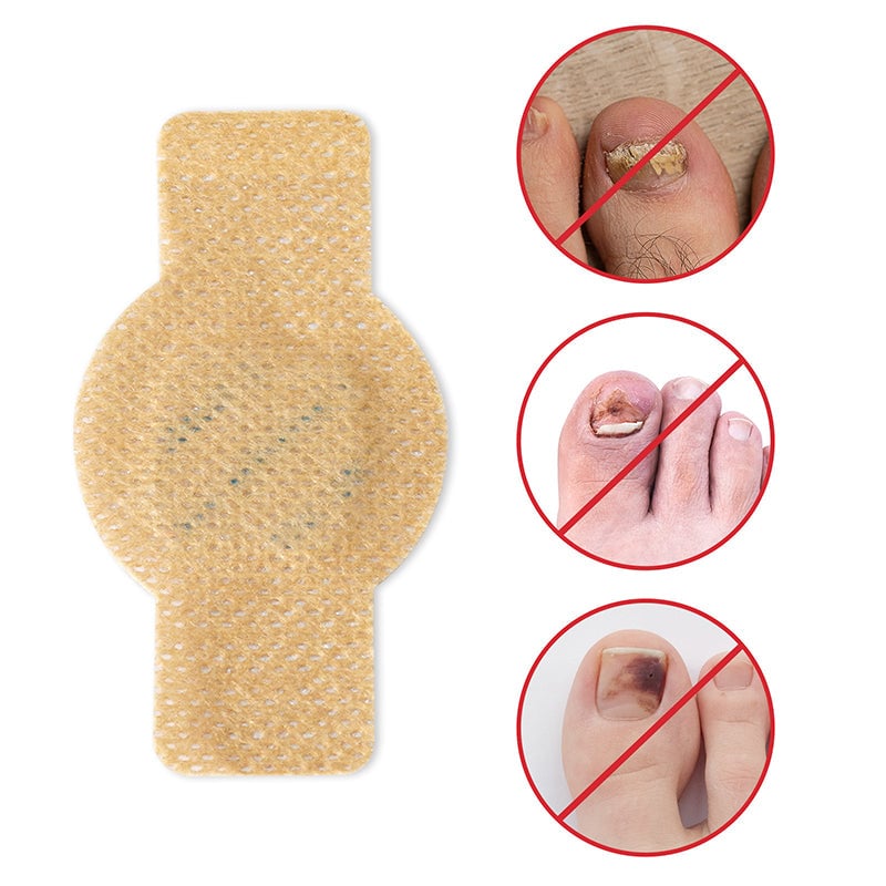 NailRepair™ | Pflaster gegen Nagelpilz