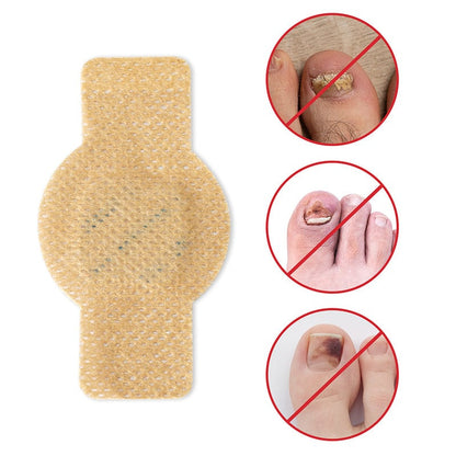 NailRepair™ | Pflaster gegen Nagelpilz