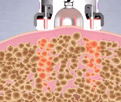RecoveryX™ | 3-in-1 für Fettverbrennung, Hautverbesserung und pure Entspannung